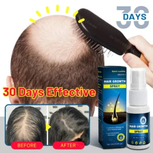 Biotin Hair Growth Serum Anti Hair Loss Products Fast Growing Prevent Dry Frizz Damaged Repair Treatment Scalp Beard Care Spray